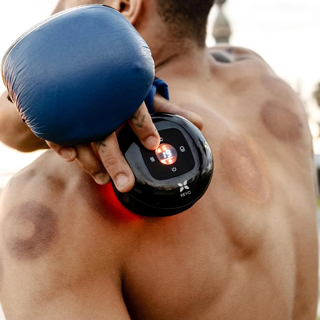 REVO™ Smart Cupping Bundle - Image 4